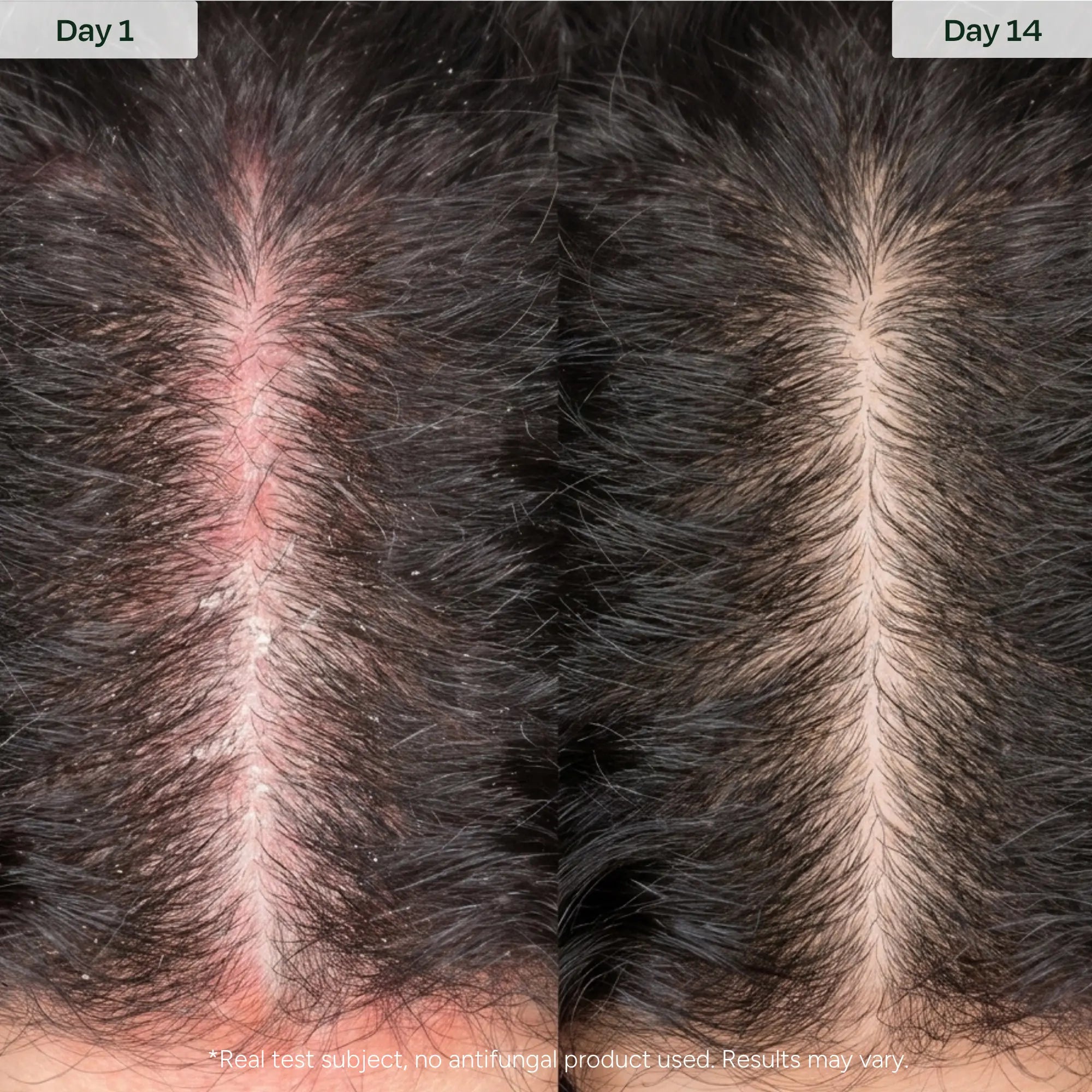Barrier Serum