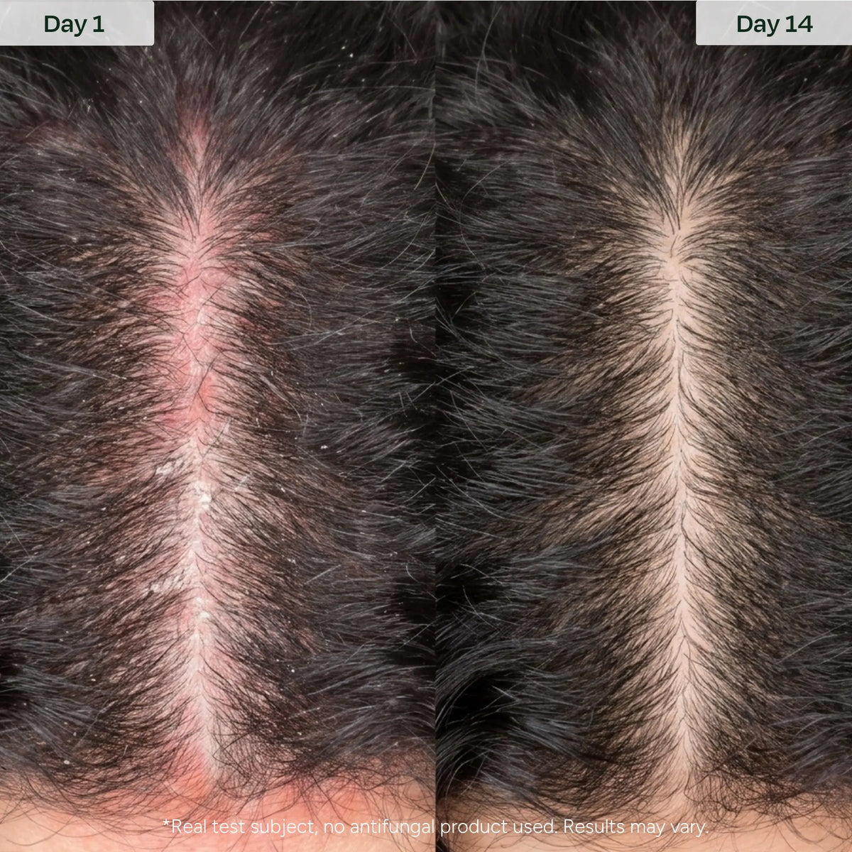 Barrier Serum
