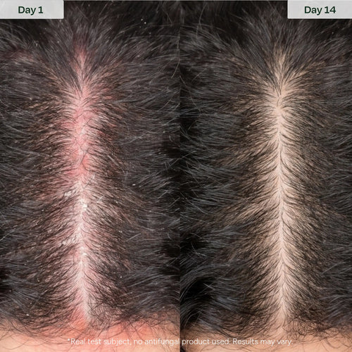 Barrier Serum